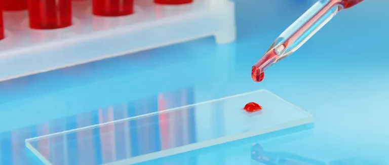 Гемоглобинопатия