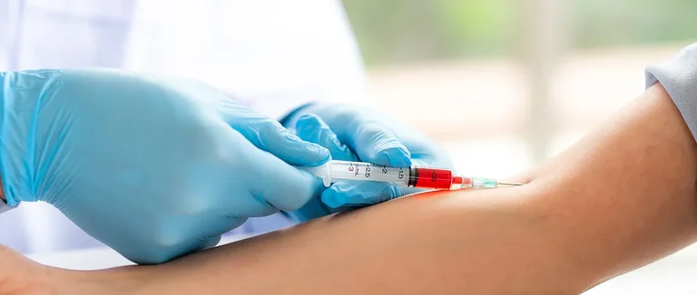 Гемоглобин SS