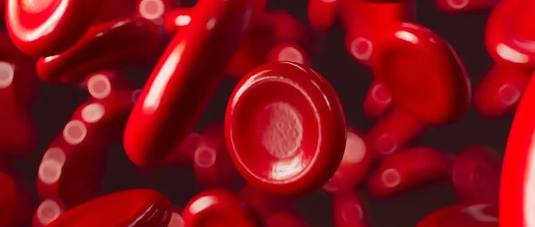 Серповидноклеточная анемия