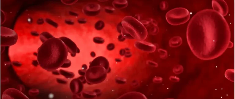 Серповидноклеточная анемия