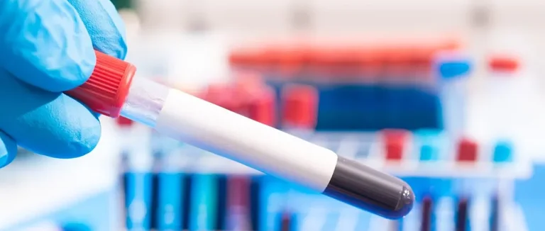 Гемофилия А