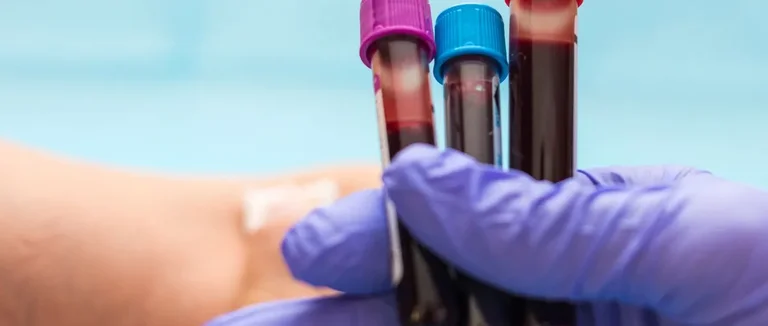 Наследственная анемия