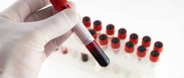 Серповидноклеточная анемия