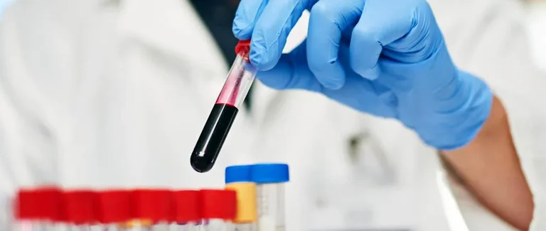 Заболевания крови