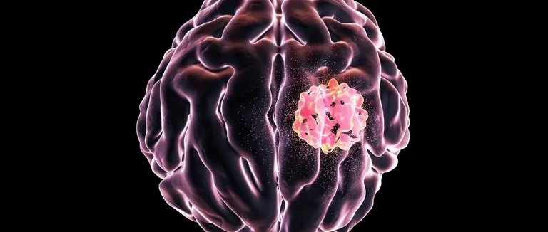 рак мозга