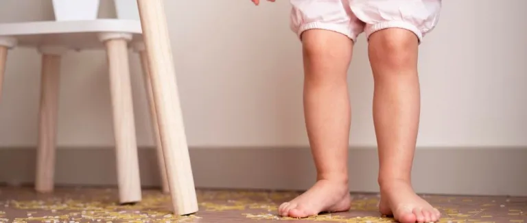 Raşitizm Belirtileri