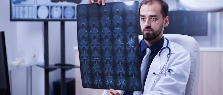 Trigeminal Nevralji nedir?