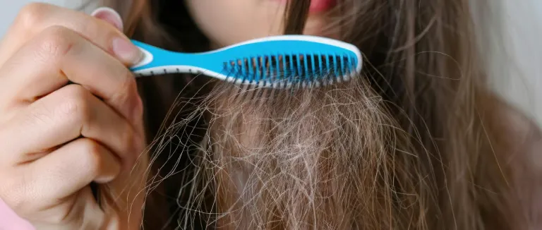 Trikotillomani (Saç Yolma Hastalığı)