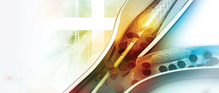 A New Hope For Cardiac Patients: Dissolvable Stent