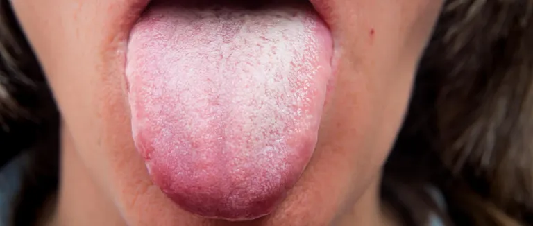 agiz-kuruluguna-ne-iyi-gelir