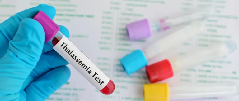 akdeniz-anemisi-tasiyicisi