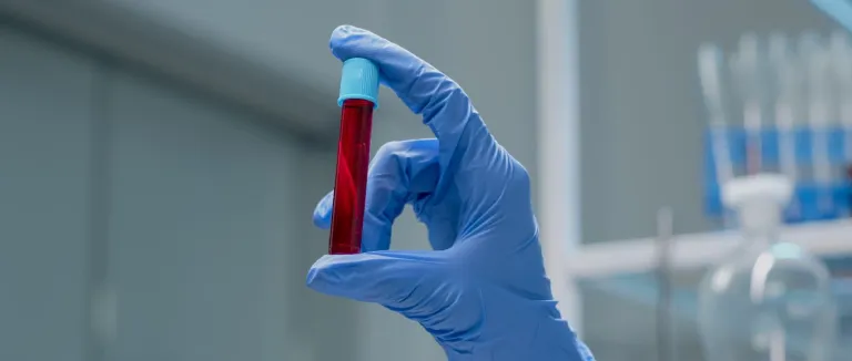 aplastik-anemi-belirtileri