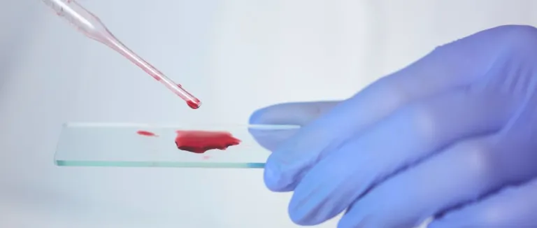 aplastik-anemi-neden-olur