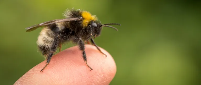 Arı Sokmasna Bağlı Alerjik Reaksiyonlar