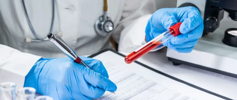 bilirubin-yuksekligi