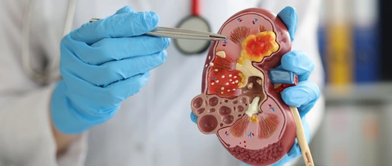 Böbrek Ağrısı tedavisi