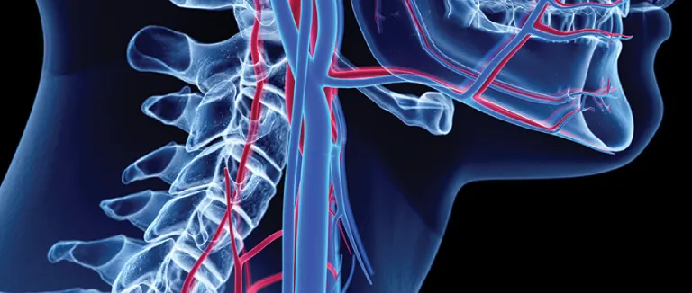 What are the causes?