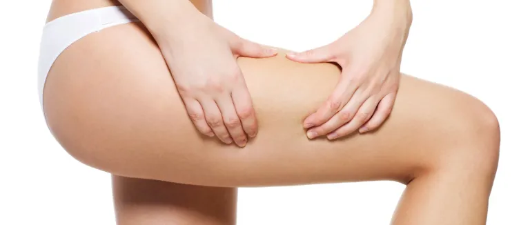 How to Treat Cellulitis?