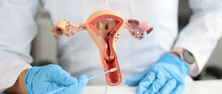 Treatment Options for Cervical Cancer