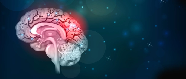 Pediatric Neurology