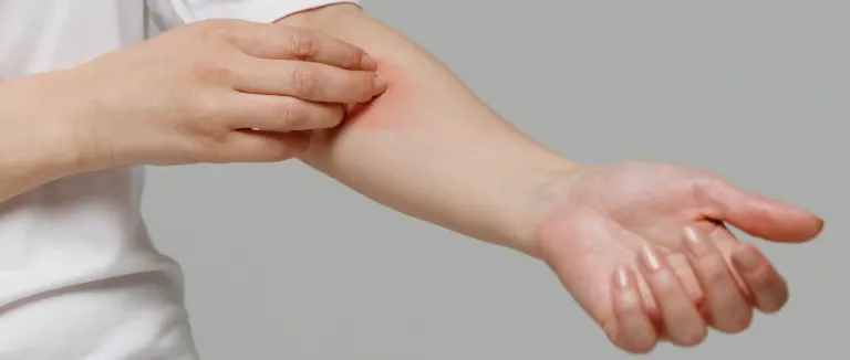 Cüzzam Hastalığı Nedir?