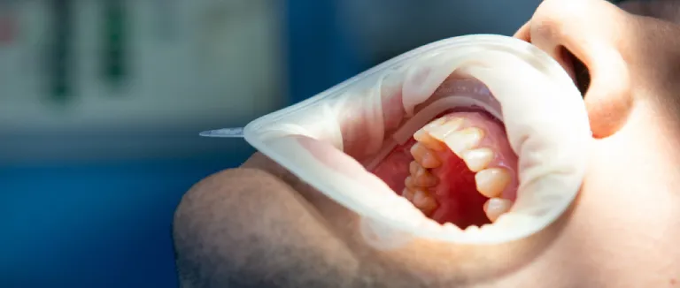 Liv Hospital - Shaping Healthy Smiles!