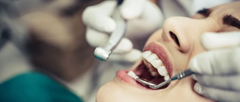 Diş Dolgusu Fiyatları