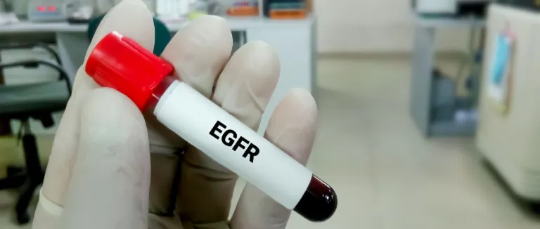 EGFR Nedir?
