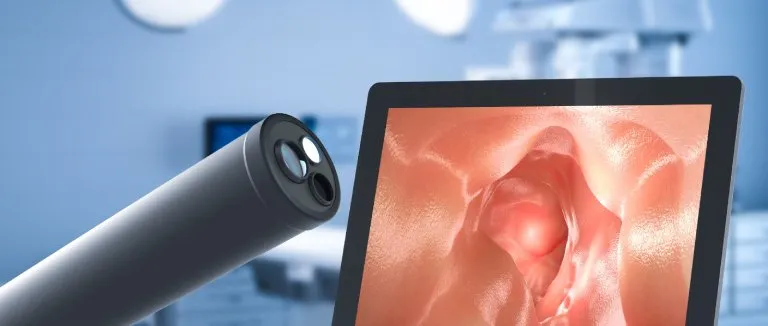 endoskopi neden yapılır?