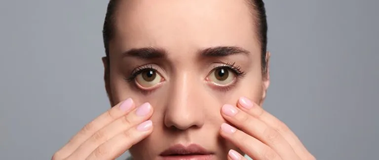 goz-kapagi-dusuklugu-ameliyati-fiyatlari