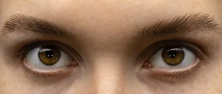 Evde göz altı morlukları nasıl geçer