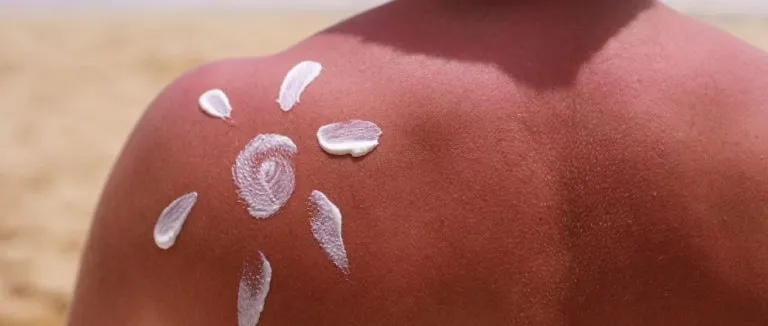 gunes-alerjisi-belirtileri-teshisi