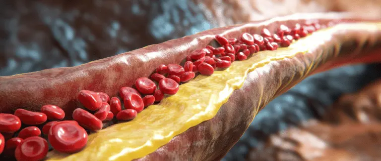 HDL Kolestrol yüksekliği