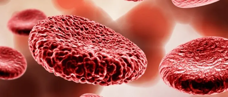 What are the Causes of Hemophilia