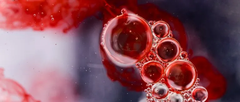 What are the Symptoms of Hemophilia