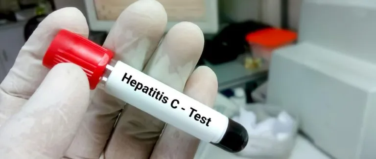 Hepatit C Nedir?
