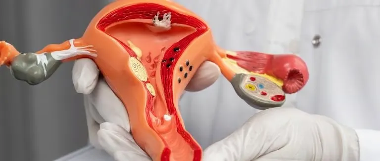 Rahimde Miyom Neden Olur?