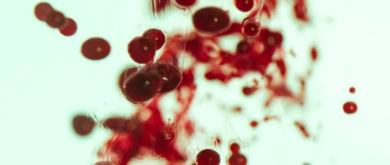 İmmün Trombositopenik Purpura