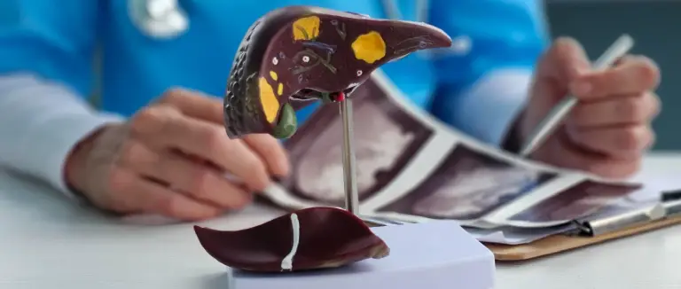 karaciger-kisti-olumculmudur.