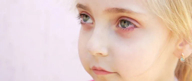 kawasaki hastalığı tedavisi