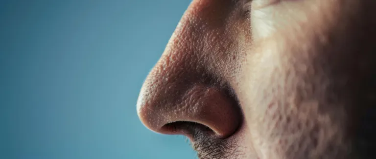 Konka Hipertrofisi (Burun Eti Büyümesi) tedavisi