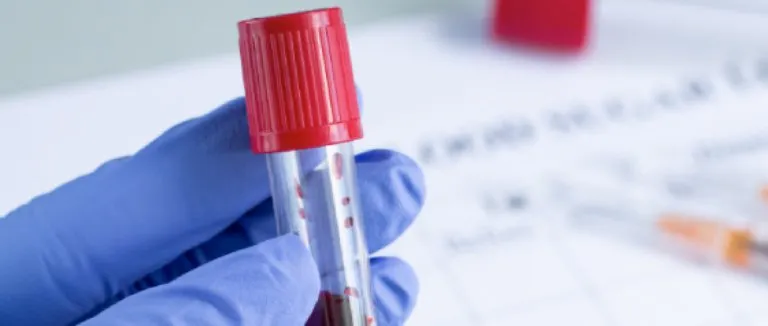 kronik-miyeloid-losemi-tedavisi