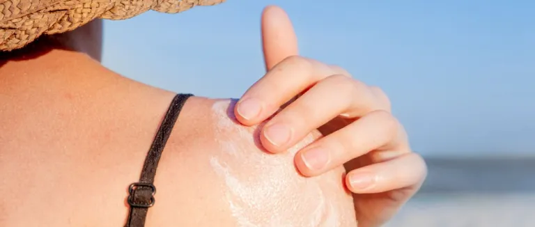 Güneş Yanığı Nasıl Geçer?