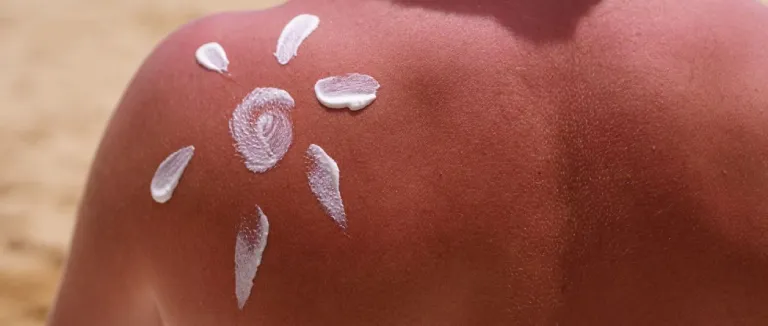 Güneş Lekesi Nasıl Önlenir?