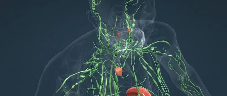 Lenf Kanseri (Lenfoma)