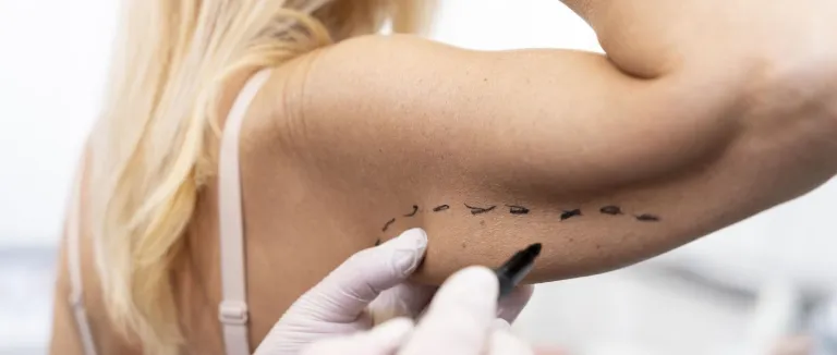 How Painful Is Liposuction