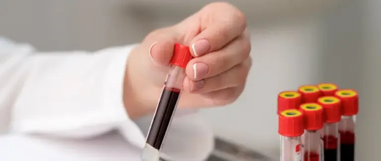 LYM Yüksekliği (Lenfositoz) Nedir?