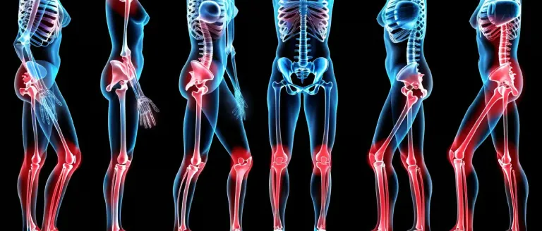 What Should Be Paid Attention to When Performing Makoplasty