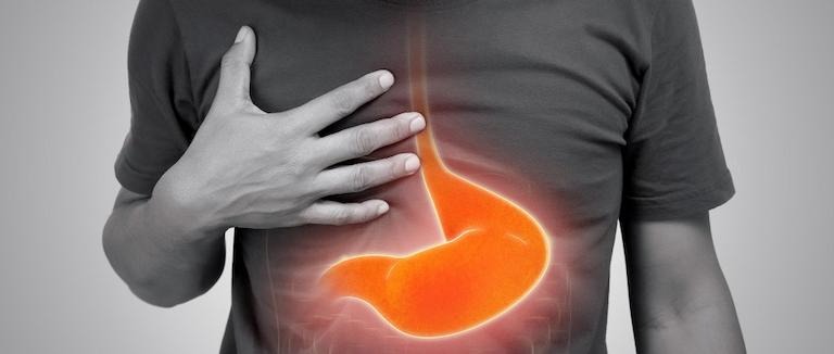 Mide Yanması belirtileri