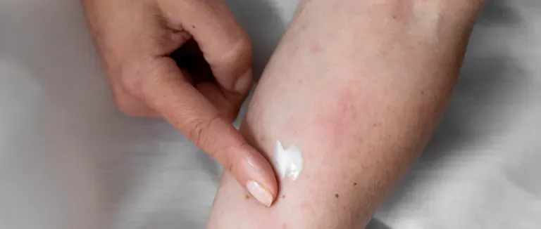 What are the Risks of Monkeypox Transmission